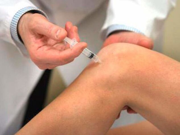 Intra-articular injection is one of the most advanced forms of knee arthrosis treatment. 