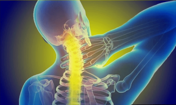 Cervical department hurts
