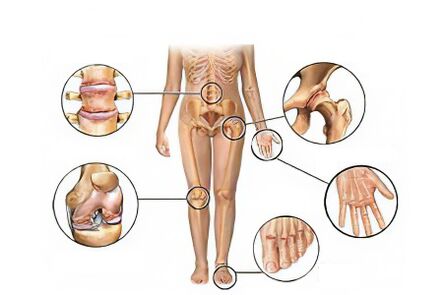 Types of arthros