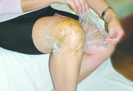 compress on the knee for arthrosis